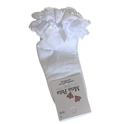 White Lace Ankle Sock